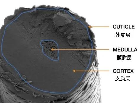 一夜白头是有心事吗,一夜白头是真实案例吗