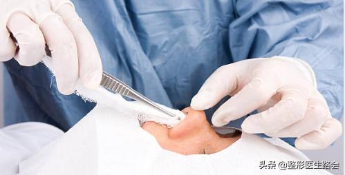 隆鼻后鼻尖发红按起疼怎么处理,隆鼻后鼻尖发紫是怎么回事