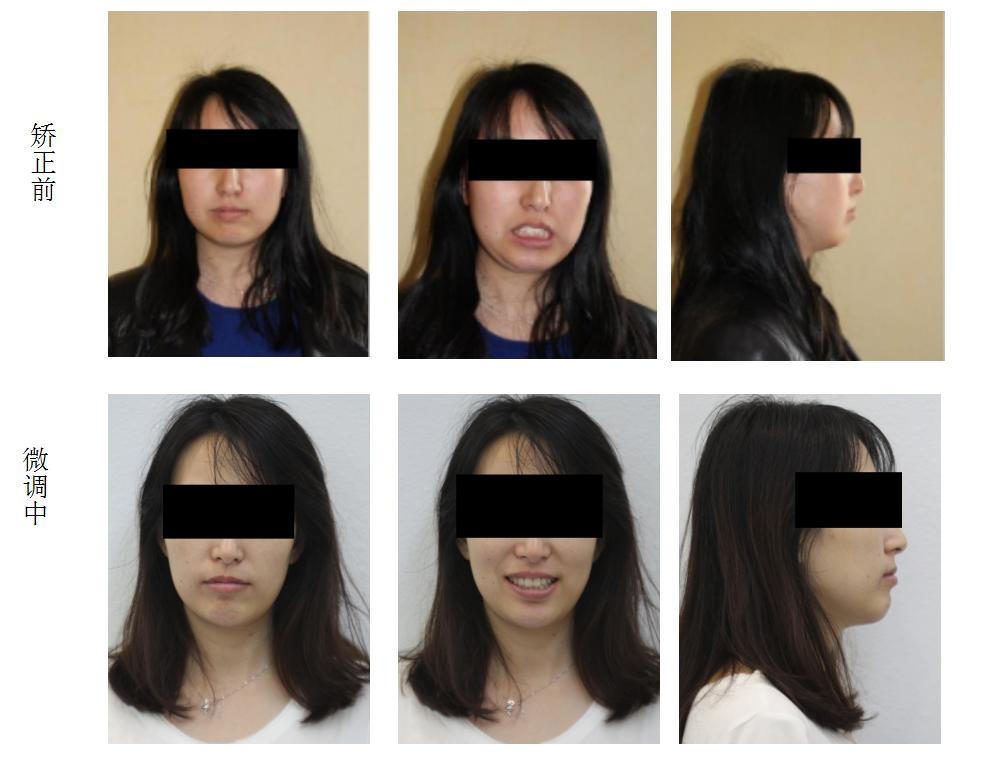 口腔医学医者仁心,口腔医学的工匠精神