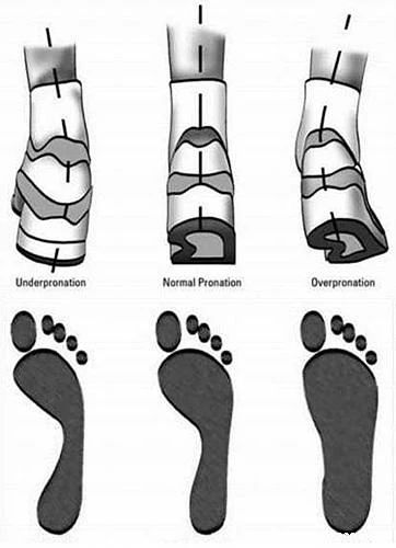 怎么判断小腿肌肉外翻和骨骼弯曲,小腿肌肉外翻和膝盖内扣一样吗