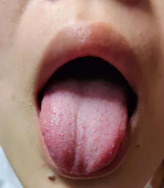 璋﹀窛涓尰,鏉窞璋﹀窛涓尰