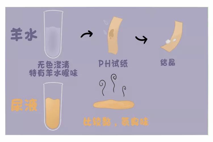 胎动异常胎儿缺氧可能性大吗,胎动异常感觉胎儿横位