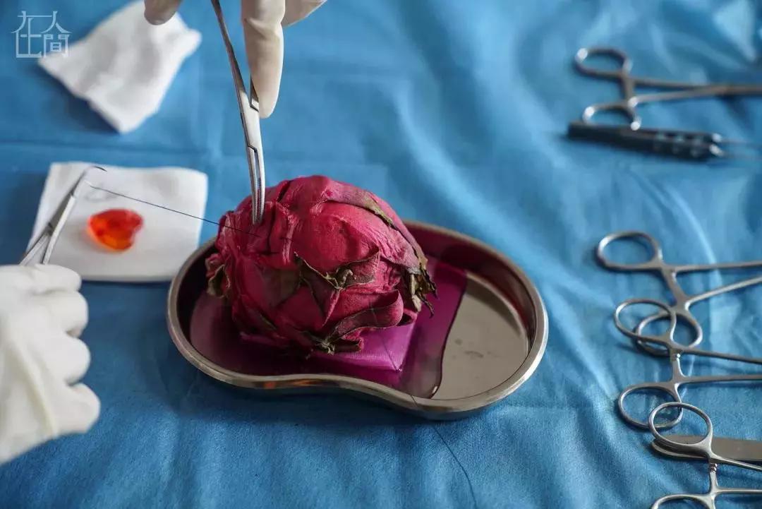 香蕉割包皮,洋葱剖腹产?这是我见过最秀的医生