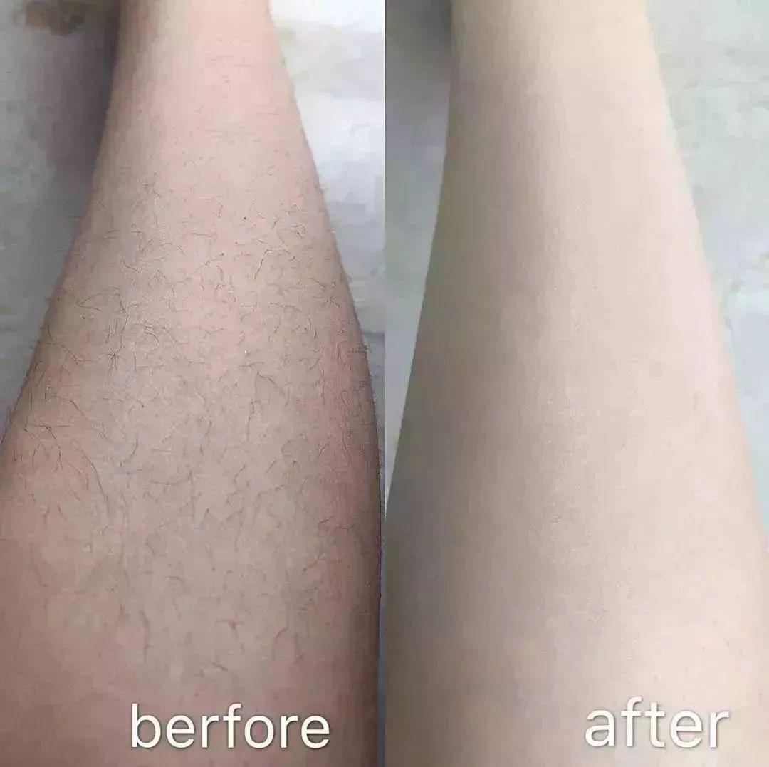 十年专注只做精品,如何零成本脱毛而且很有效