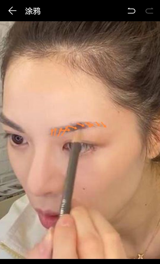 无眉星人怎么治疗,无眉星人怎么补救