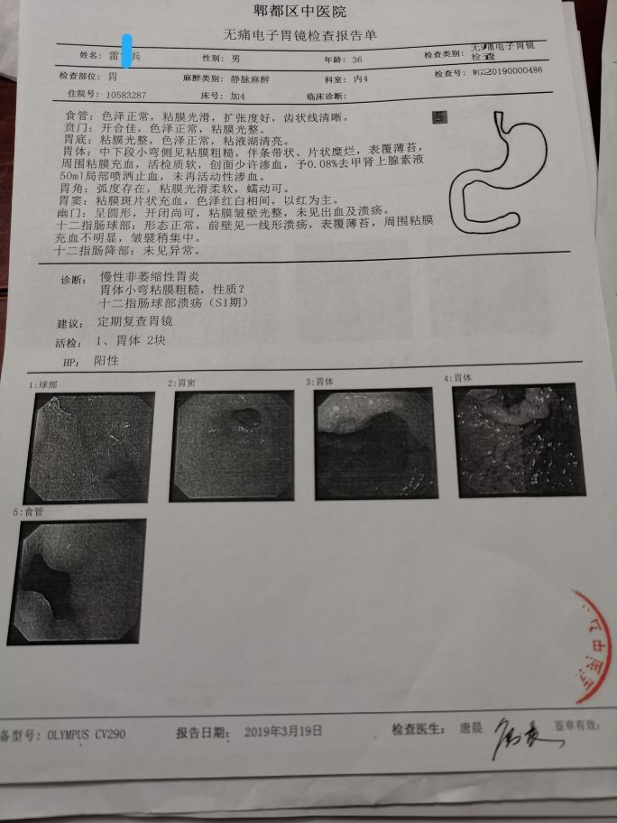 一个逆转的萎缩性胃炎患者自述,萎缩性胃炎被逆转了