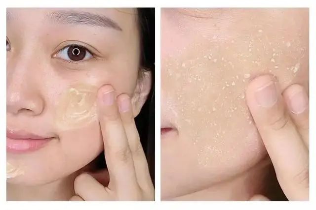 林允打的眼周水光针是什么,林允怎么那么有钱