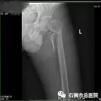 石狮市骨科医院,石狮市总医院骨科多少钱