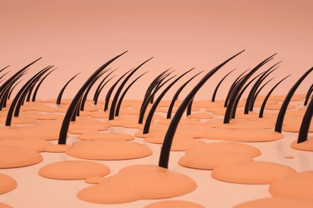 产后脱发严重怎么调理头顶都秃了,为什么有的人产后脱发特别严重