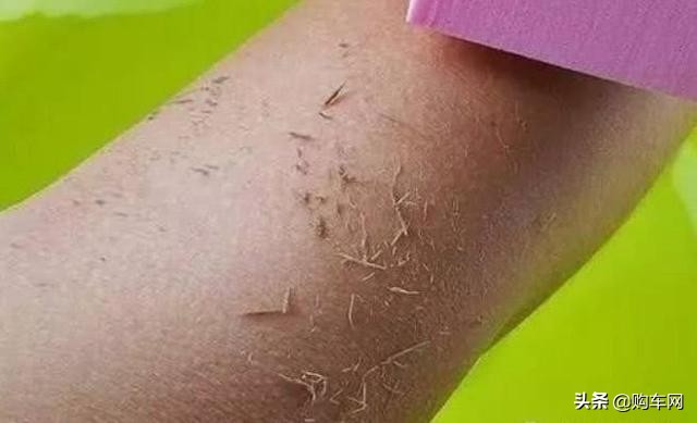 洗澡时搓出泥状物好不好,搓泥搓出来白色的是什么