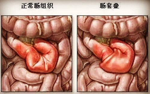 宝宝无缘无故哭闹是冷处理还是哄,宝宝晚上哭闹需不需要就医