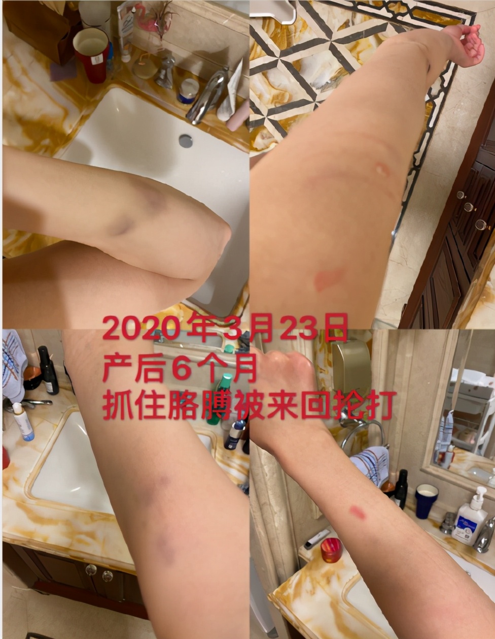 人面兽心家暴男,人面兽心新婚之夜被家暴