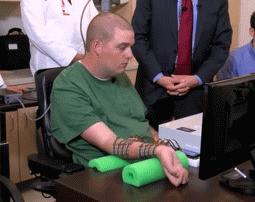 肌肉萎缩会导致什么严重后果,肌肉萎缩有什么症状和危害