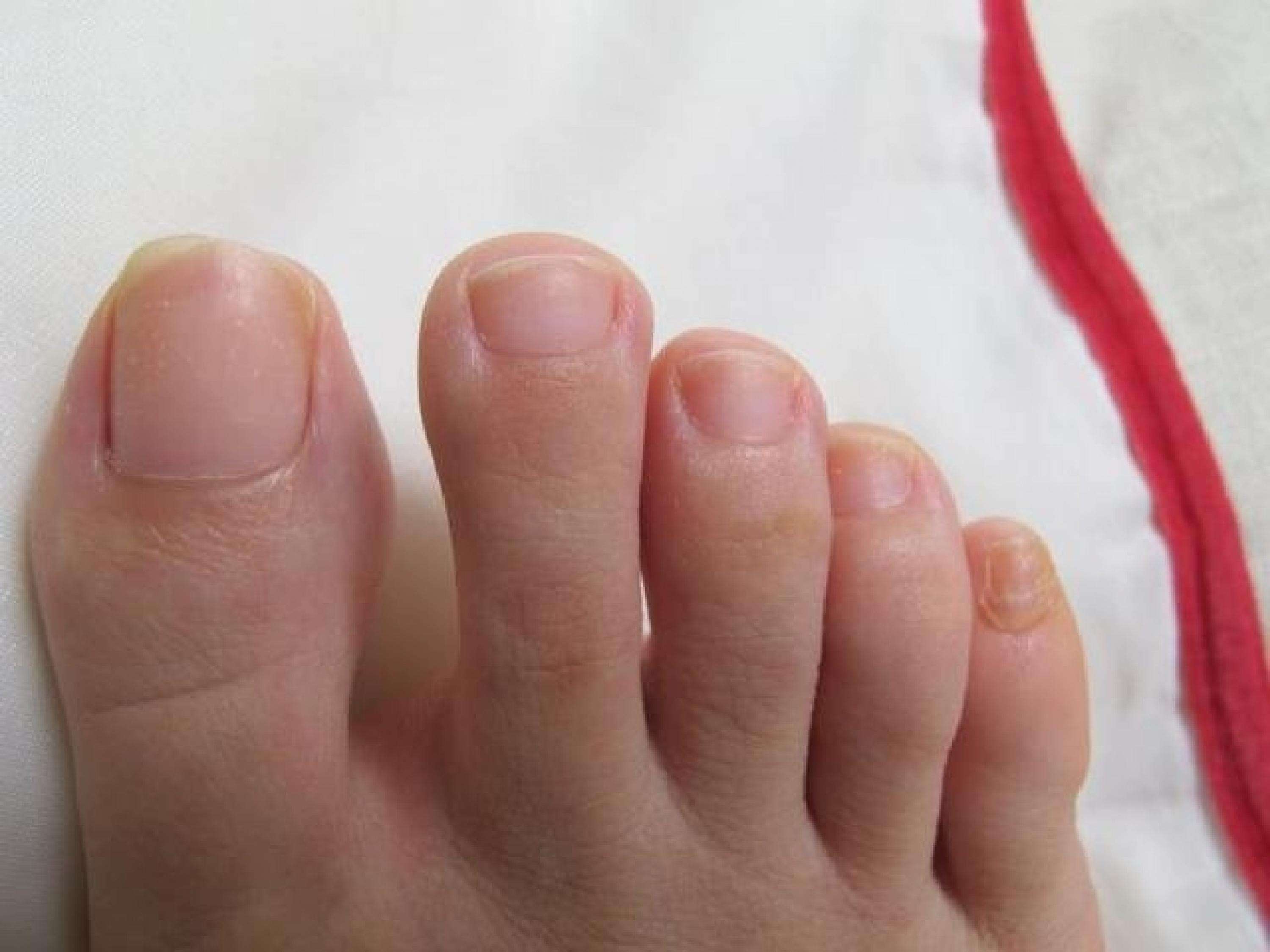 脚上有什么代表肾出了问题,男人脚上肾的反射区