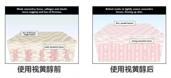 拯救毛孔粗大测评,毛孔粗大拯救全过程