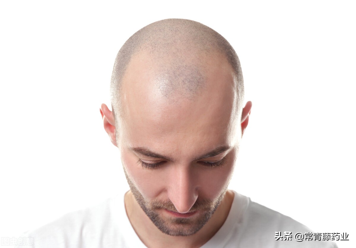 只使用米诺地尔生发有效吗 (米诺地尔生发用多久才有效)