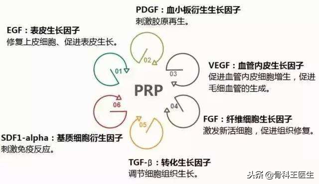 指南推荐！关节炎新疗法，PRP到底是何方神圣？