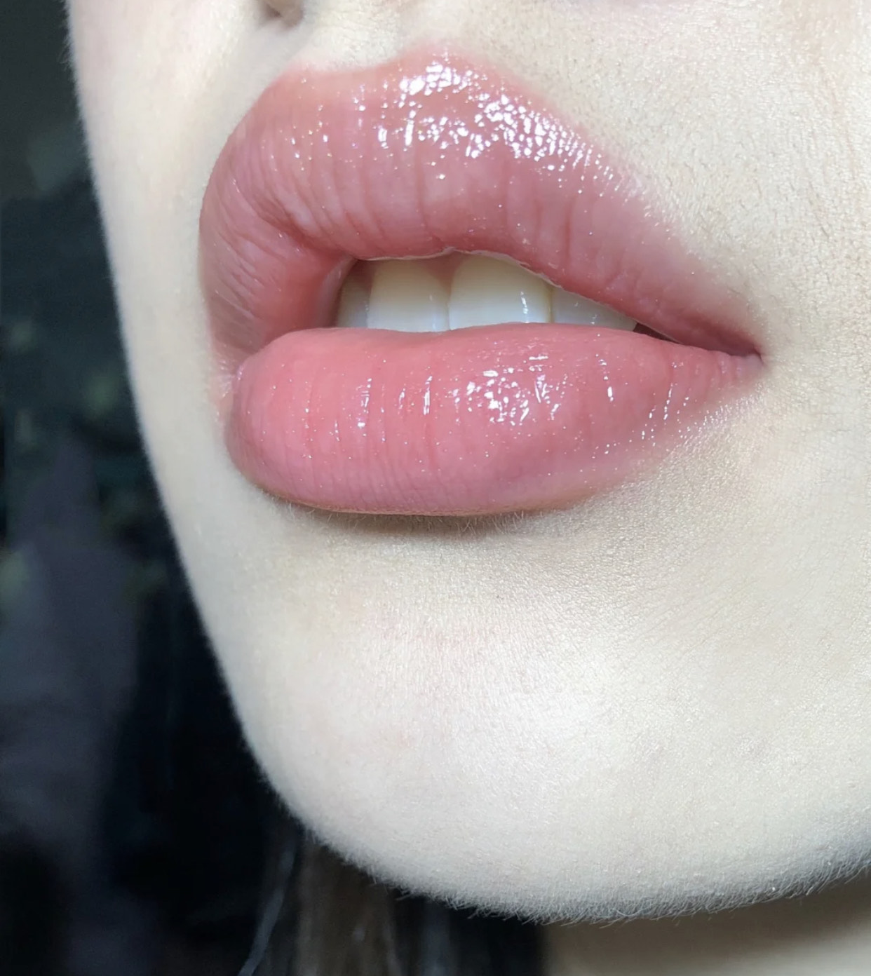 唇干唇裂涂什么唇膏比较好,唇干唇裂用什么唇油