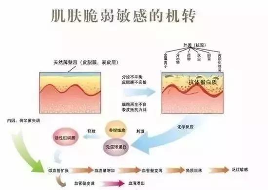 油敏干敏是什么症状,如何区别干敏和油敏