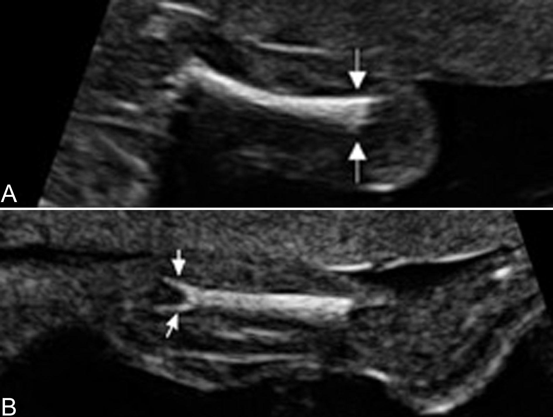 明明白白做ct检查,明明白白做超声