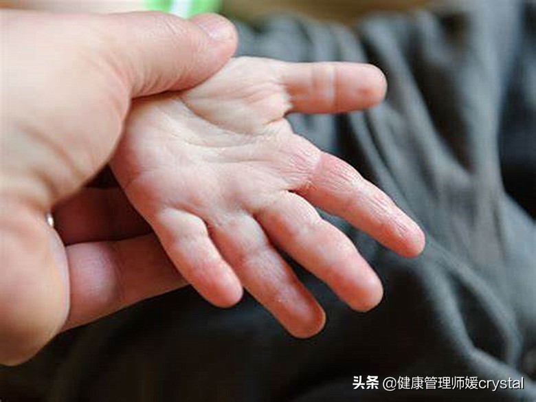 宝宝大便便秘干结急救,宝宝大便干燥便秘用什么药较好