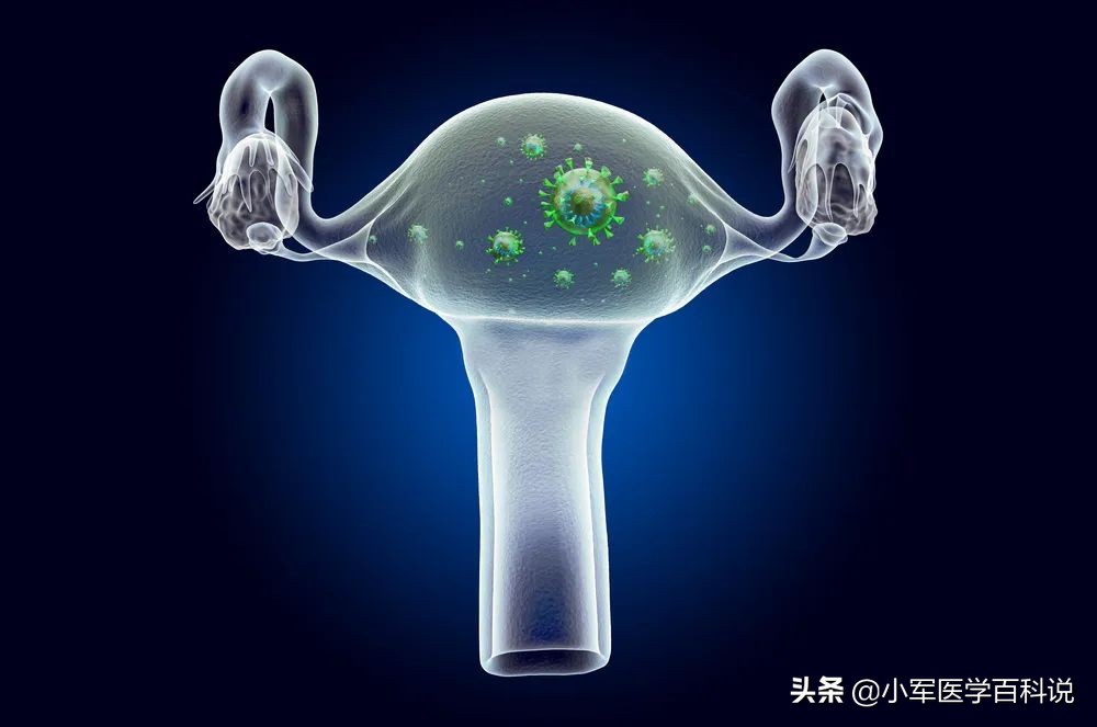 hpv感染能打宫颈癌疫苗吗,感染hpv一定会得宫颈癌吗