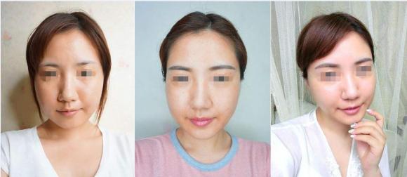 更年期月经不来了该怎么办,月经推迟和提前哪个容易卵巢早衰