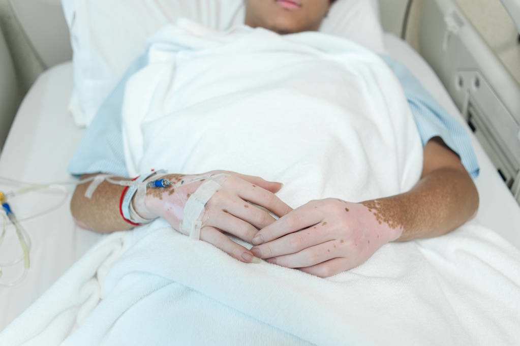 白癜风激光308有什么危害,白癜风会对患者造成哪些危害