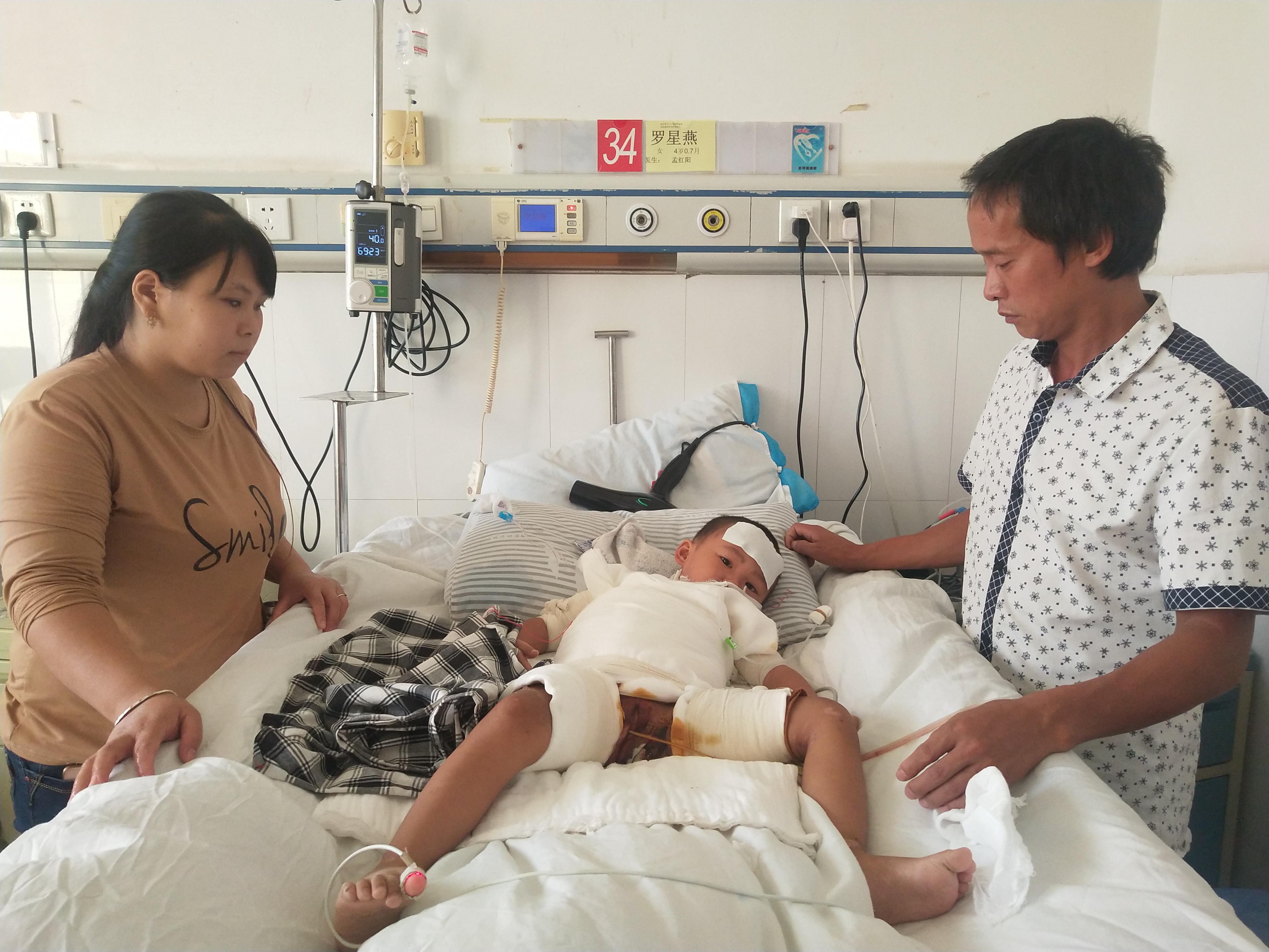 小孩被烫伤妈妈求助好心人,4岁女童重度烫伤父母含泪求助