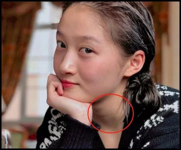 有的人为啥天生就有颈纹,颈纹明显无法掩饰是女神