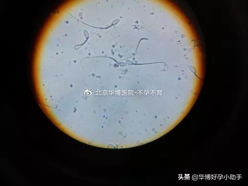 精子量少会影响生育吗,精子量少一定不育吗