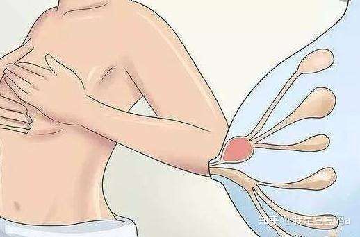 哺乳期堵奶有硬块吃什么药,哺乳期妈妈堵乳了怎么办