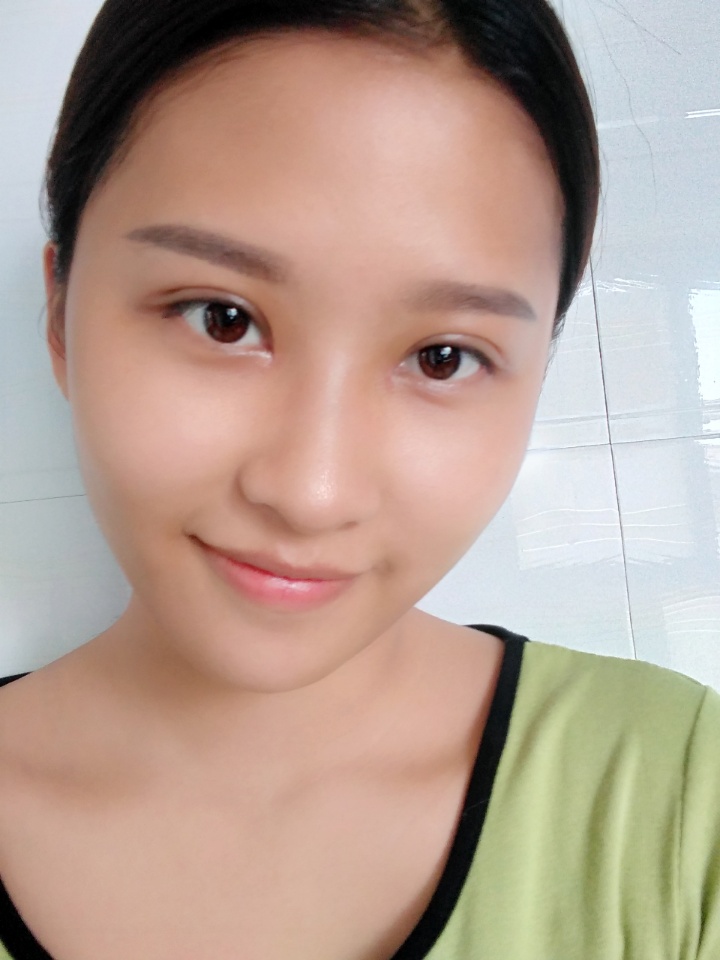 韩美做双眼皮,南昌韩美医院做双眼皮怎么样