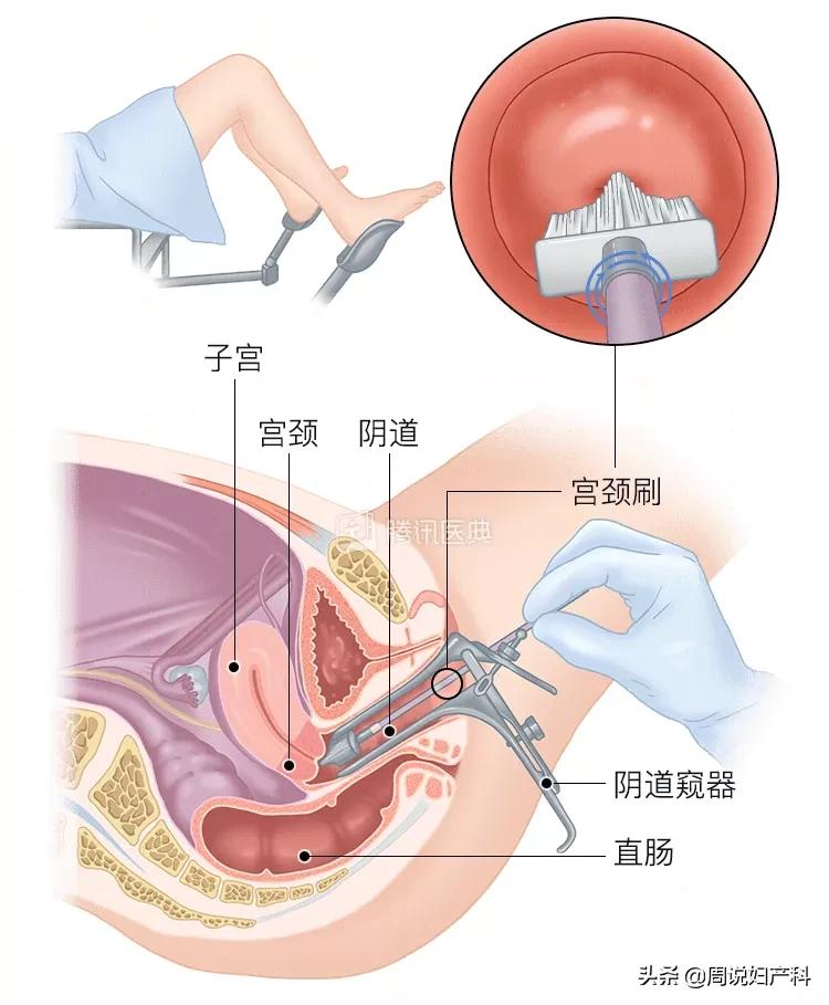 第一次看妇科竟然花了7000块!这份妇科避坑指南快收好
