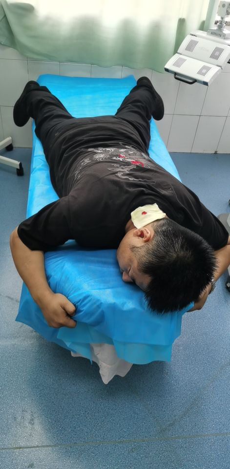 无麻痛不欲生,火疖子引流手术亲身经历