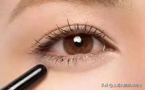 上海九院孙沣博士眼角修复,孙沣修复外眼角