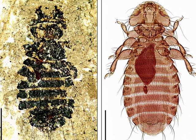 七八十年代人人头上有虱子,80年代时人们为什么会有虱子