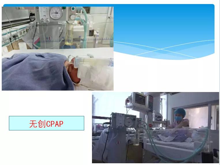 好消息儿科,nicu新生儿重症病房