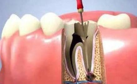 牙疼不再是问题教你如何缓解牙疼,牙疼有什么方法缓解牙疼