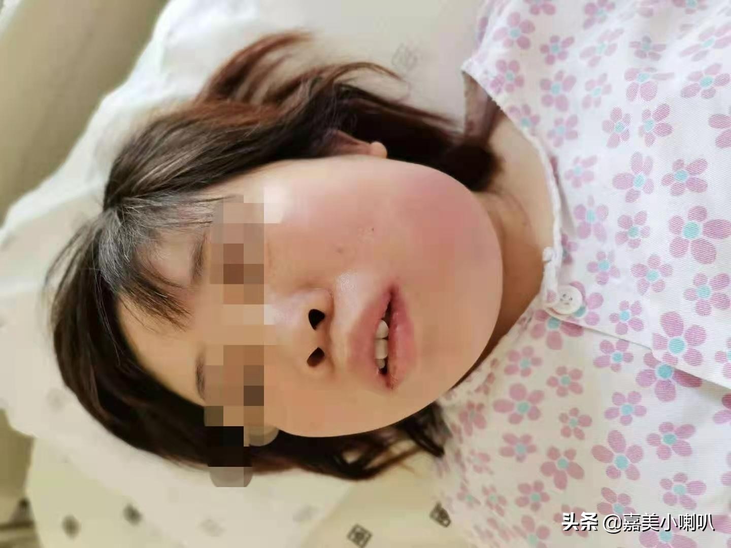 崩溃!孕妇智齿化脓——幸运!聊城东昌妇幼解难题