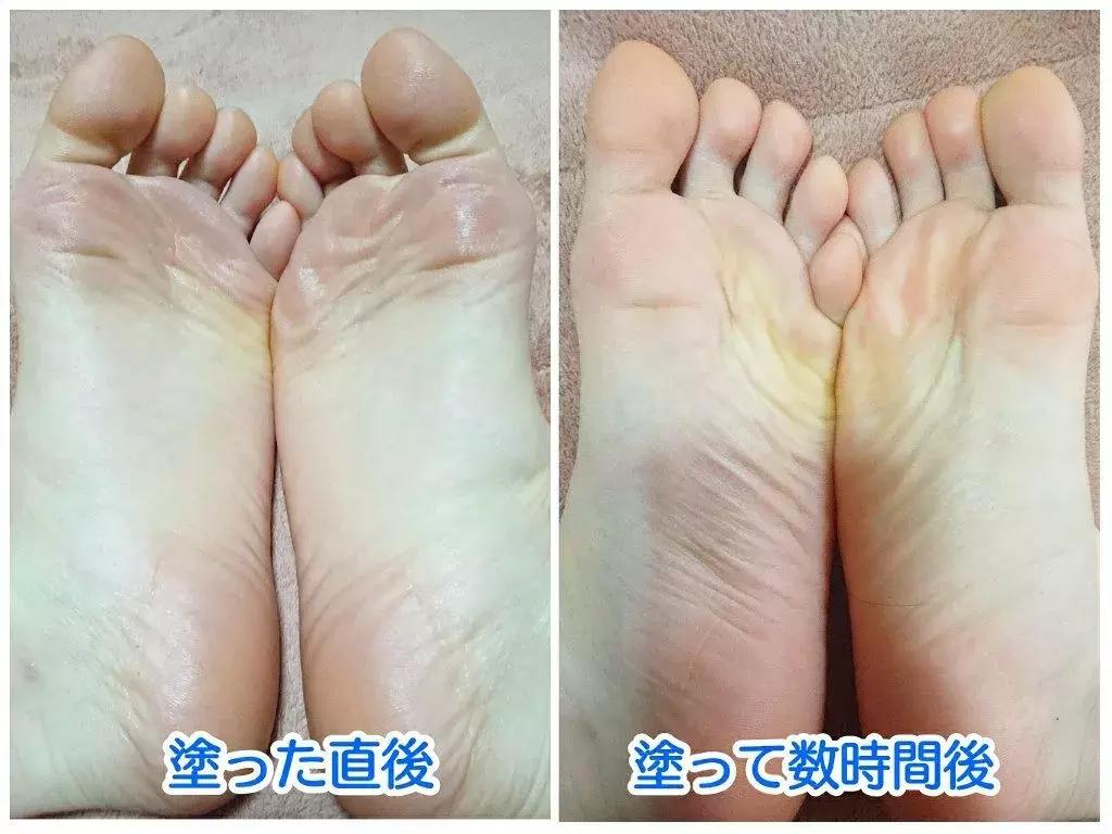 女大学生脚部异味难忍,在寝室羞于脱鞋!