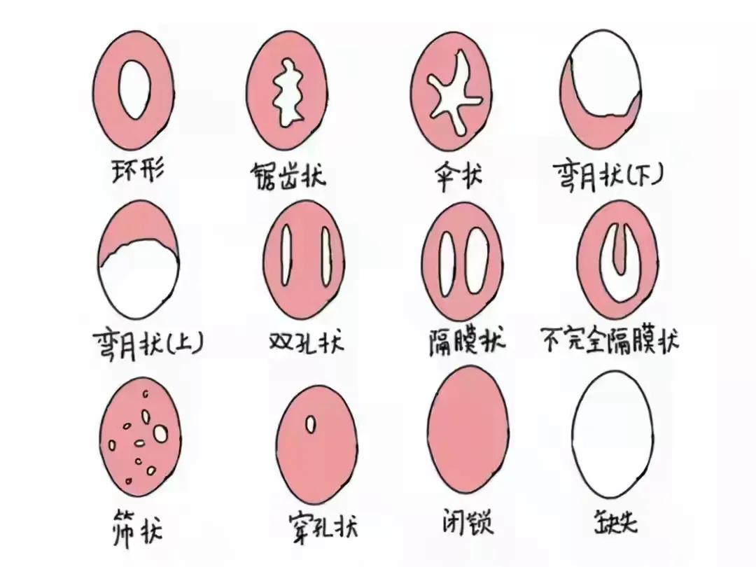 处女的第一次都会流血吗？会不会有例外？一次性科普到位