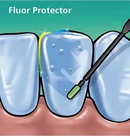 什么是牙齿脱矿原因与疗法你都知道吗？