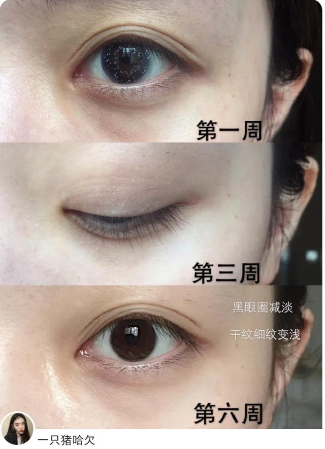 精选5款贵妇眼霜推荐,4大眼霜