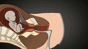 堕胎可怕吗,堕胎到底多可怕