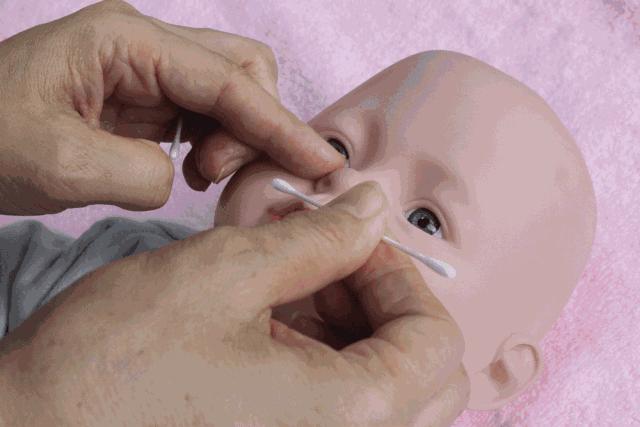 宝宝换季皮肤问题多妈妈怎么办,宝宝夏季皮肤问题