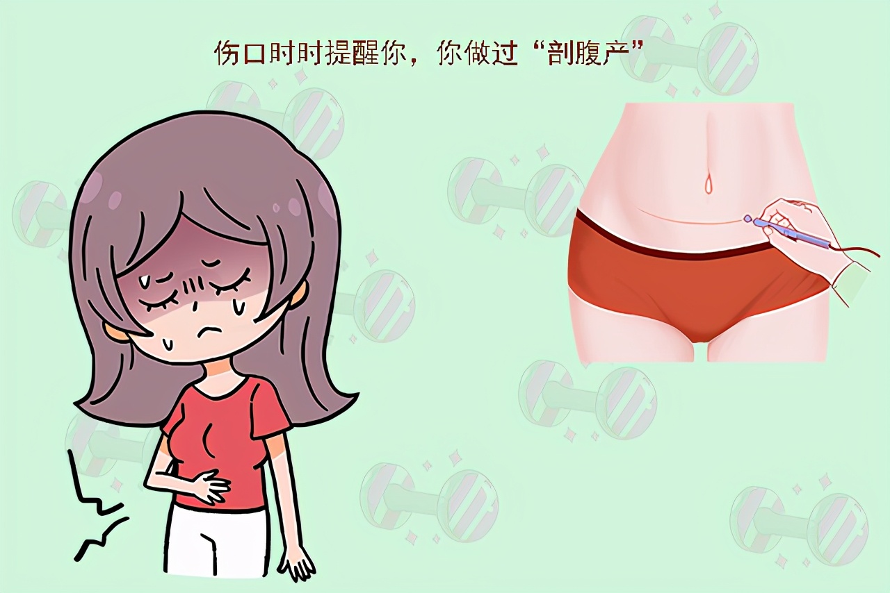 妈妈剖腹产之苦,妈妈剖腹产好多年刀口疼