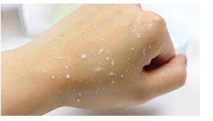 怎么解决腋下黑,如何改善腋下黑