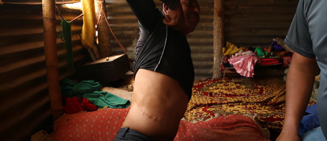 尼泊尔“卖肾村”，村民900美元“高价”卖肾，人人身上一道疤