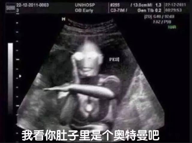 孕妇做b超胎儿在开车视频,b超胎儿开车